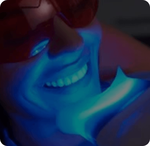Teeth whitening with LED light treatment