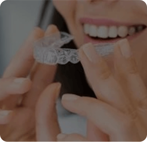 Clear aligner being placed on teeth